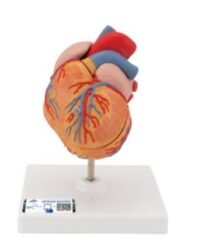 CORAZÓN CLÁSICO CON HIPERTROFIA VENTRICULAR IZQUIERDA (HVI), DE 2 PIEZAS - 3B SMART ANATOMY